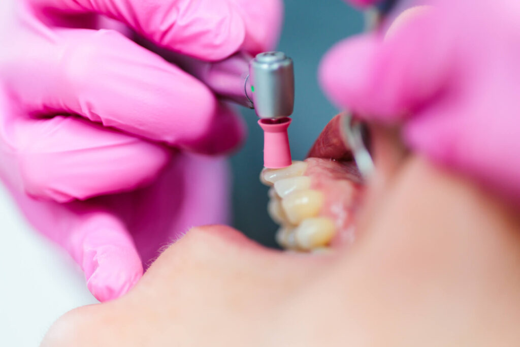 Prophylaxe | Zahnarztpraxis in Rietberg